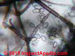 Verticillium like fungal spores and hyphae (C) Daniel Friedman